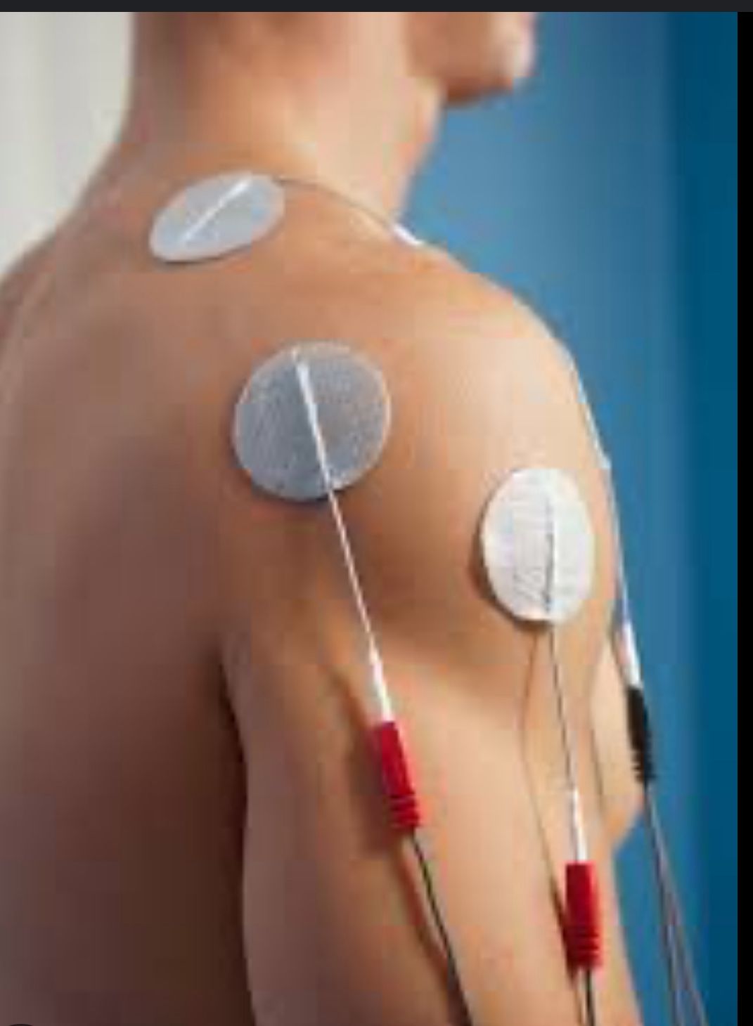 TENS Machine